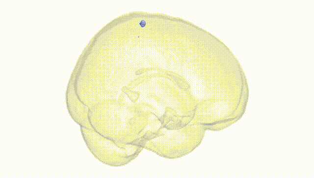 Full Brain White