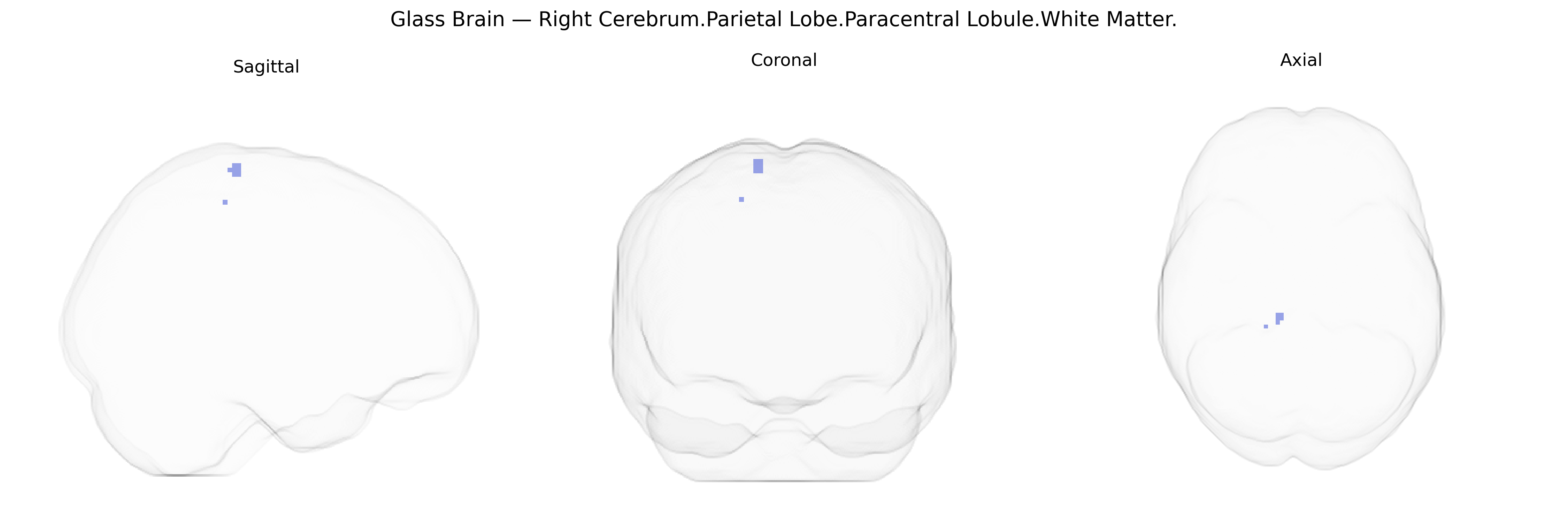 Triplanar Ghost Brain