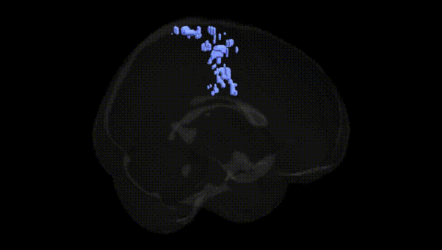 Full Brain Black