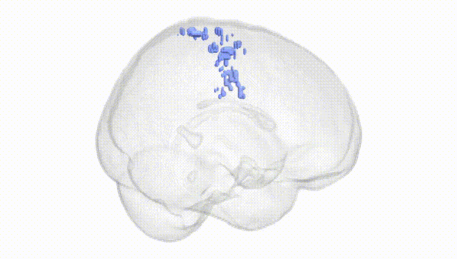 Full Brain White