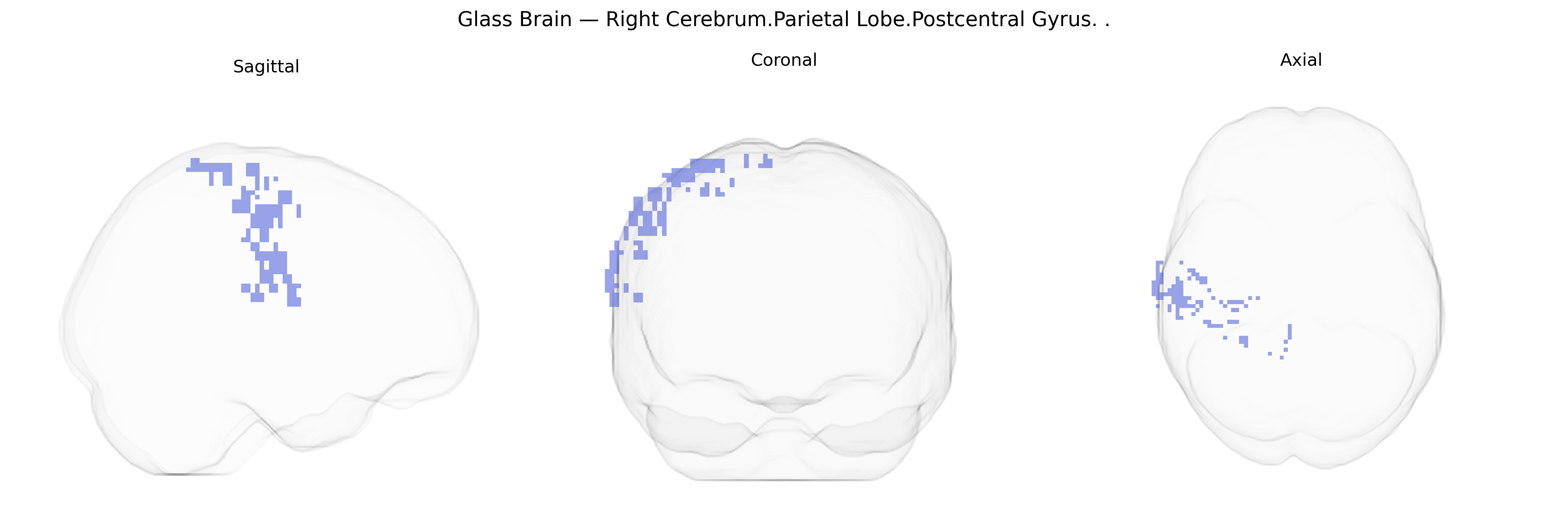 Triplanar Ghost Brain