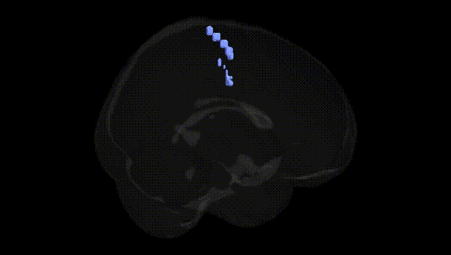 Full Brain Black