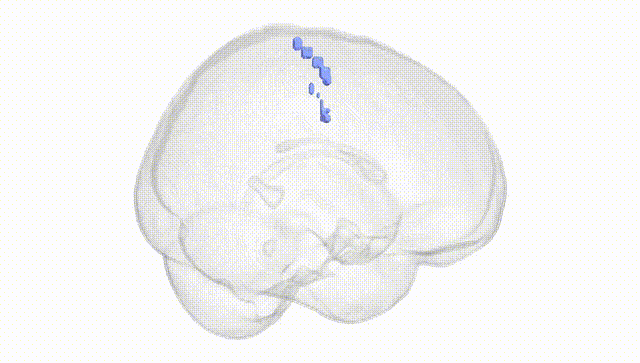 Full Brain White