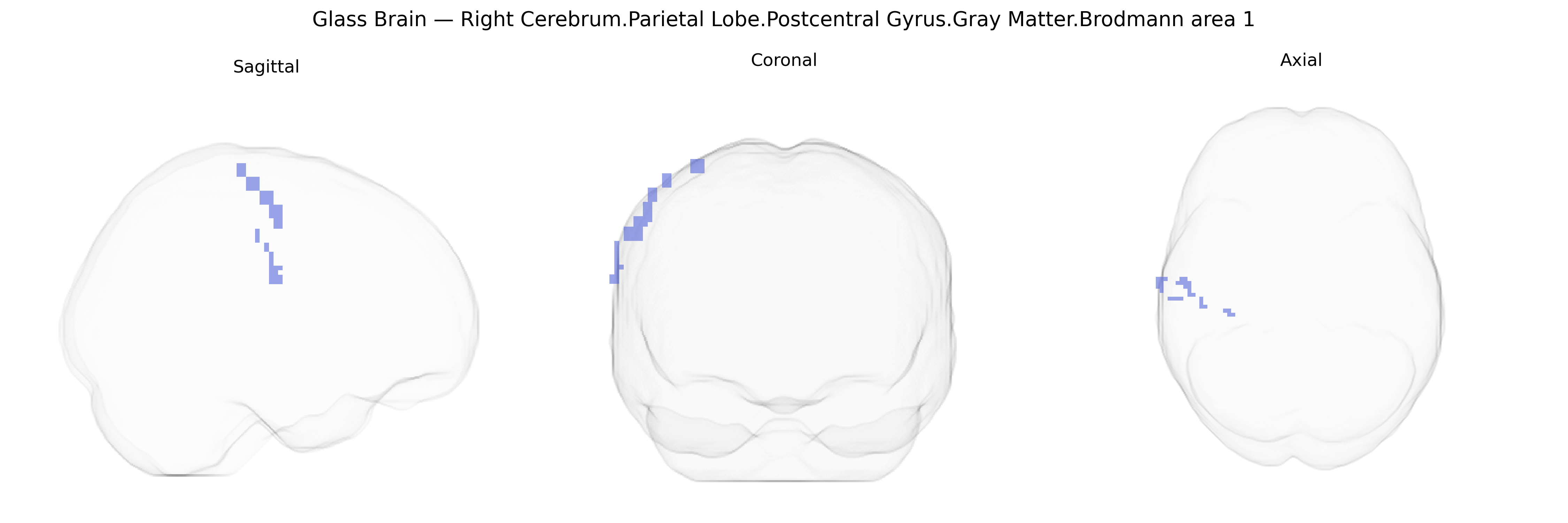 Triplanar Ghost Brain