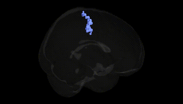Full Brain Black