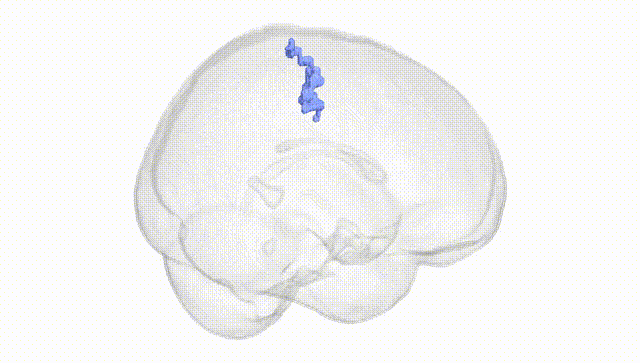 Full Brain White
