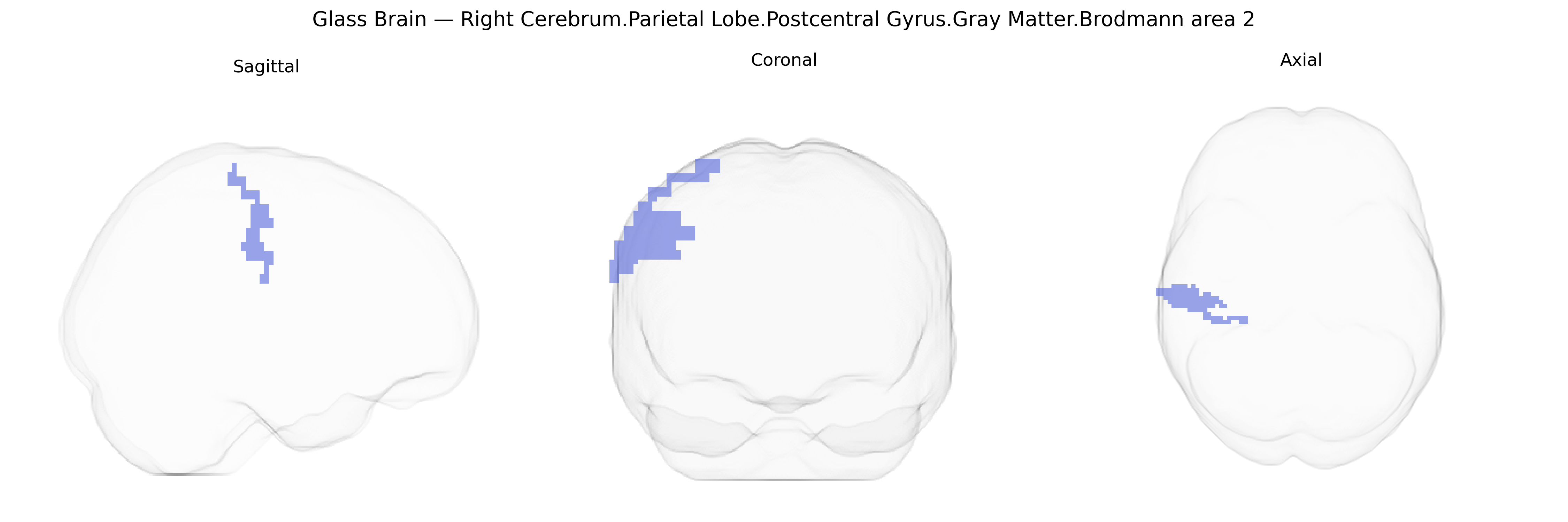 Triplanar Ghost Brain