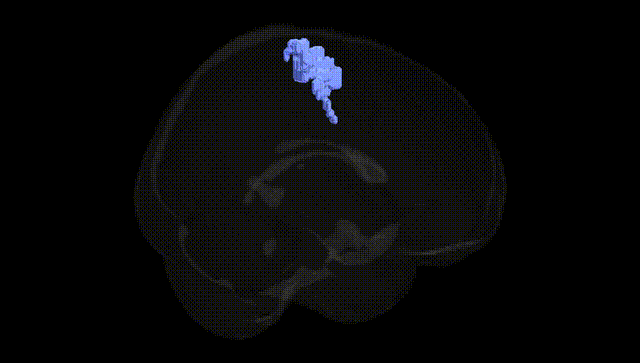 Full Brain Black