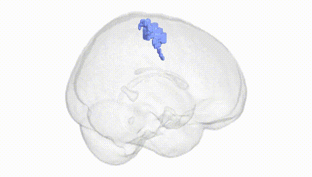 Full Brain White