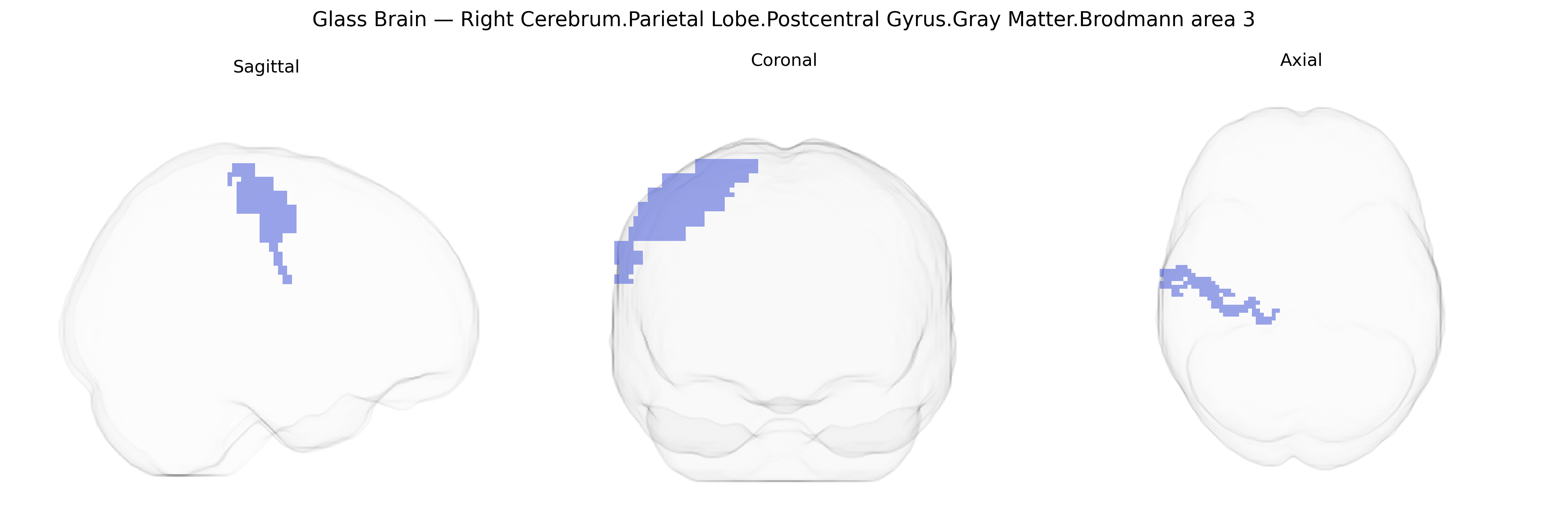 Triplanar Ghost Brain