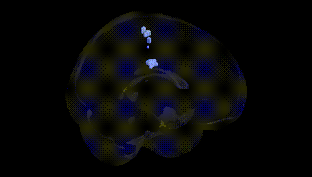 Full Brain Black