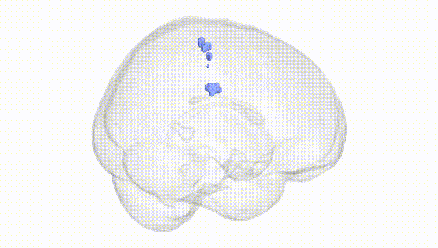 Full Brain White