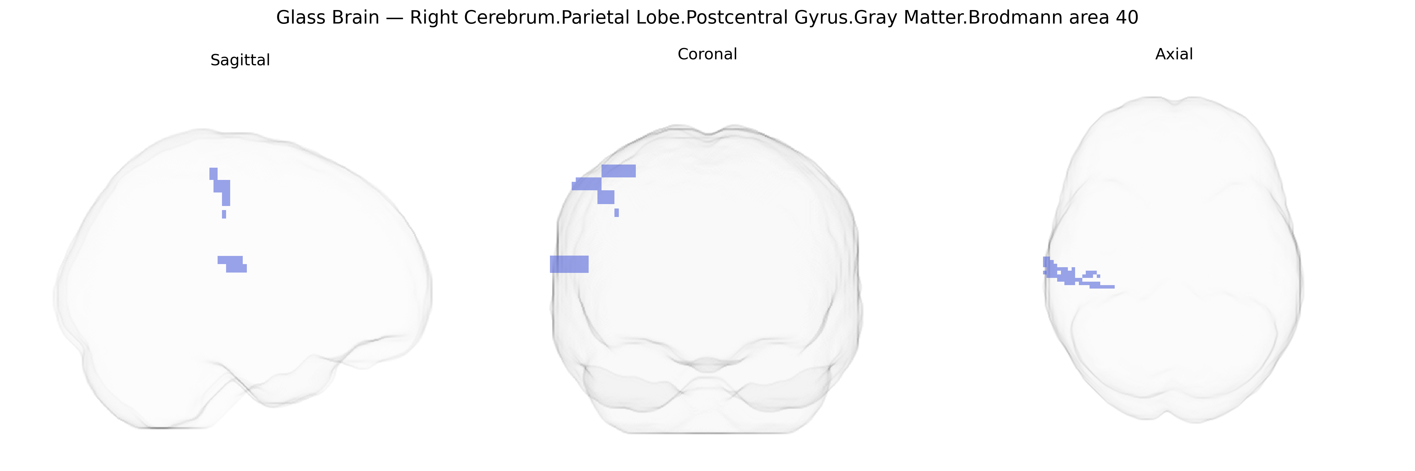 Triplanar Ghost Brain