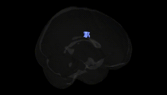 Full Brain Black
