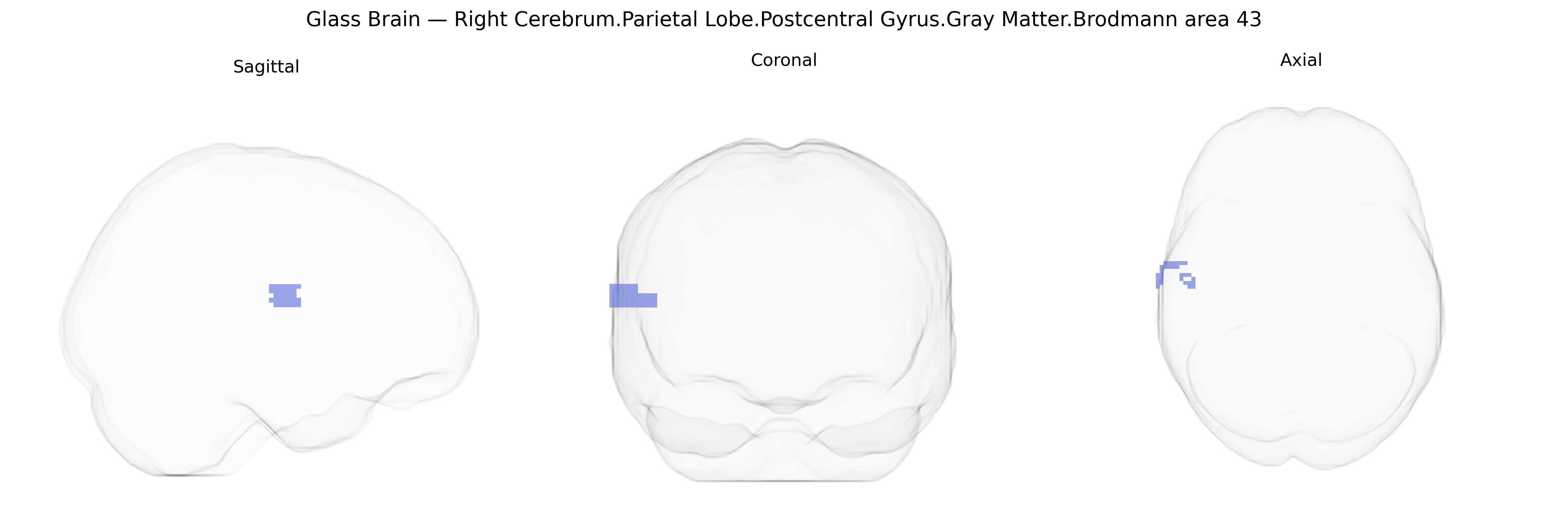 Triplanar Ghost Brain