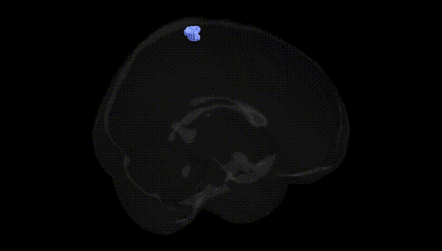 Full Brain Black