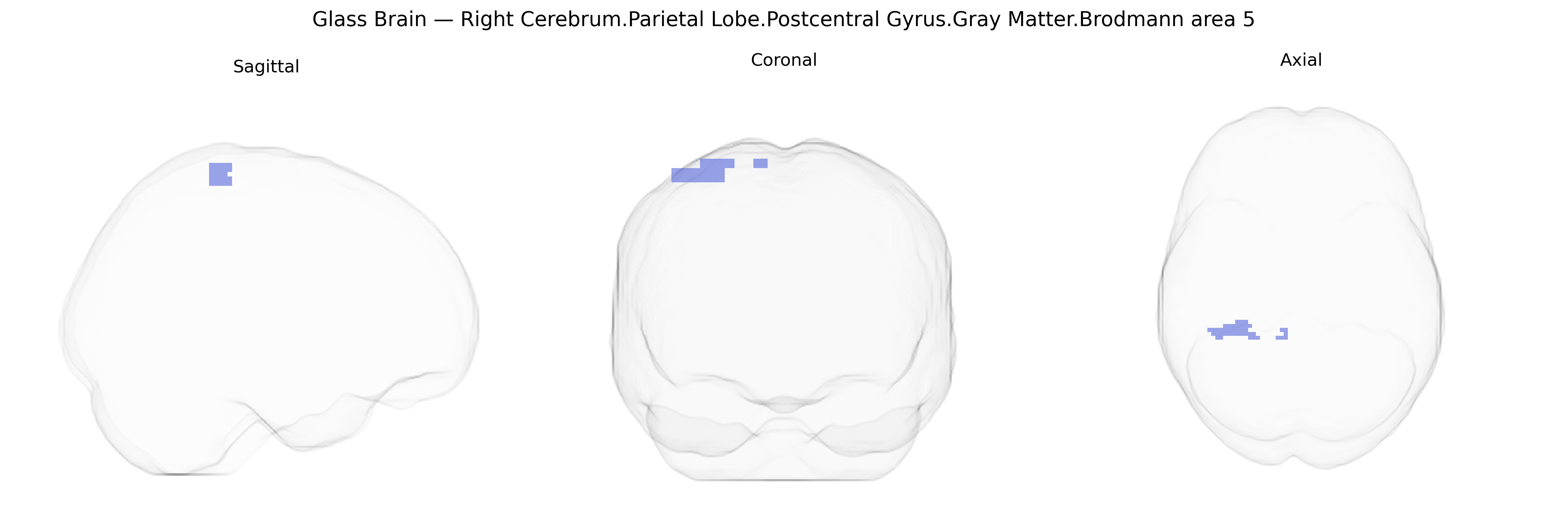 Triplanar Ghost Brain