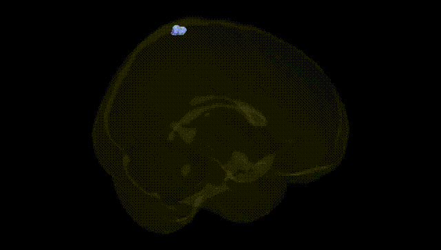 Full Brain Black
