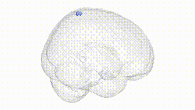 Full Brain White