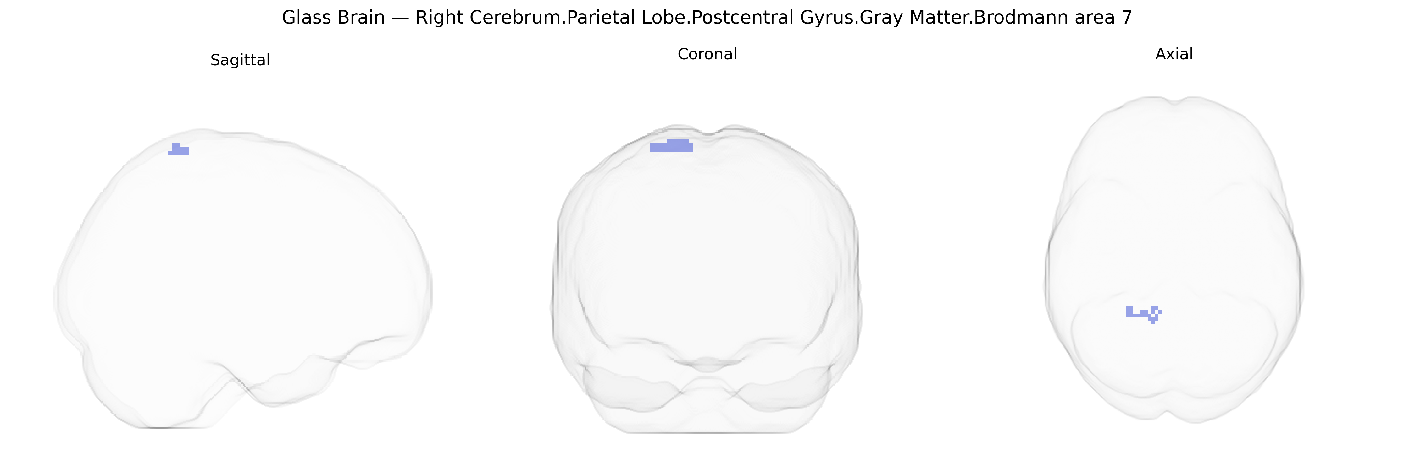 Triplanar Ghost Brain