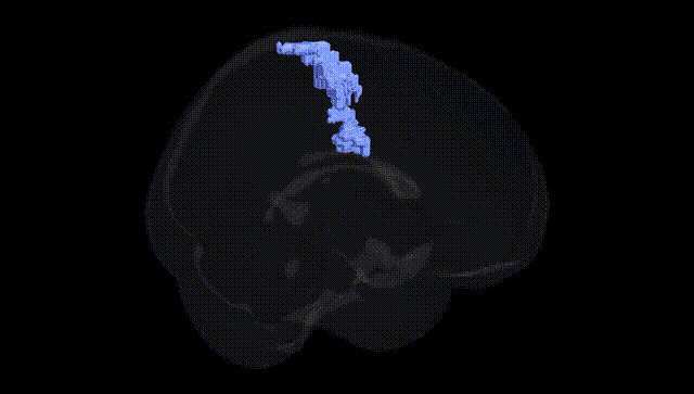 Full Brain Black