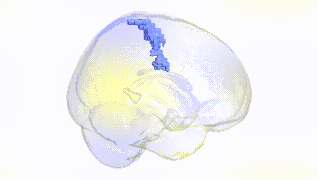 Full Brain White