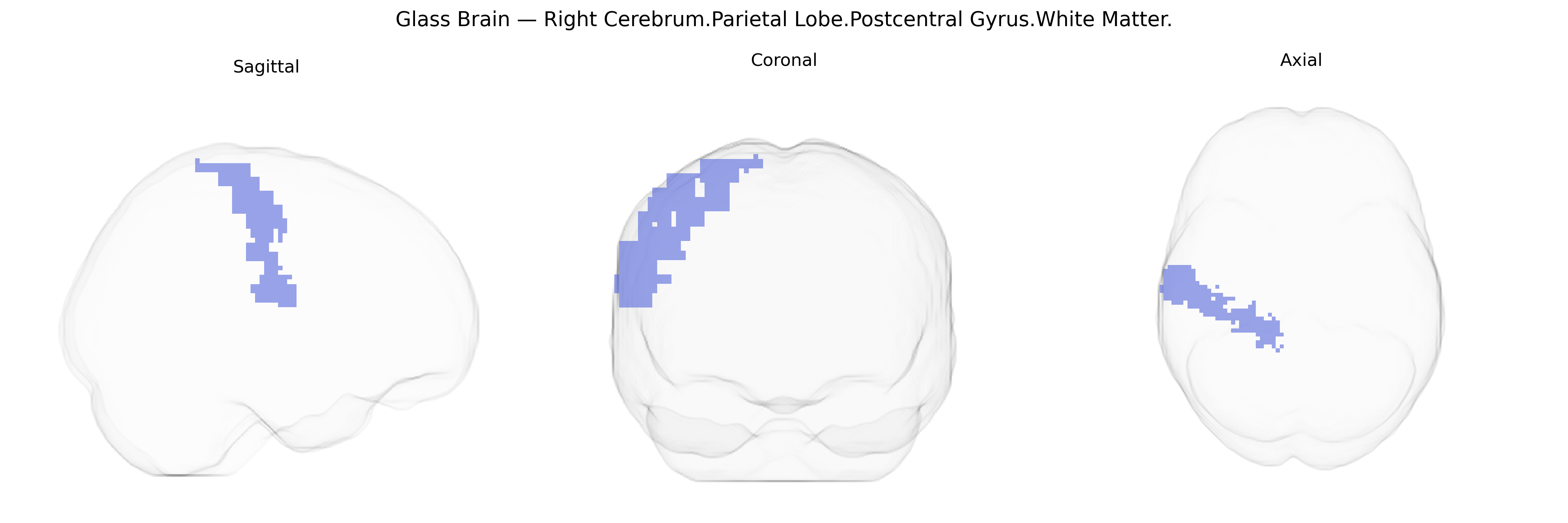 Triplanar Ghost Brain