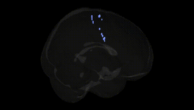 Full Brain Black