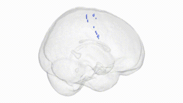 Full Brain White