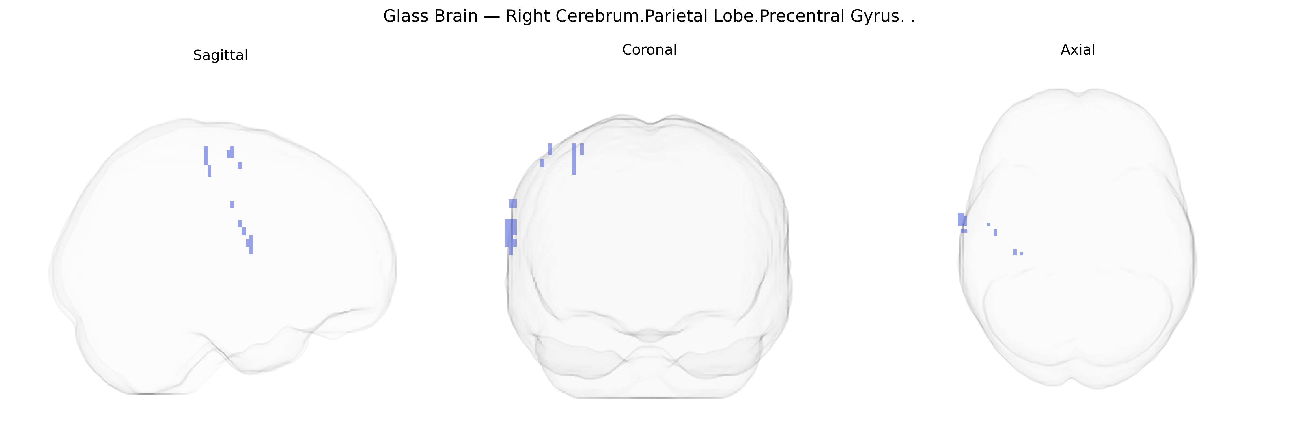 Triplanar Ghost Brain