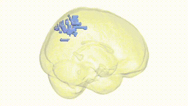 Full Brain White