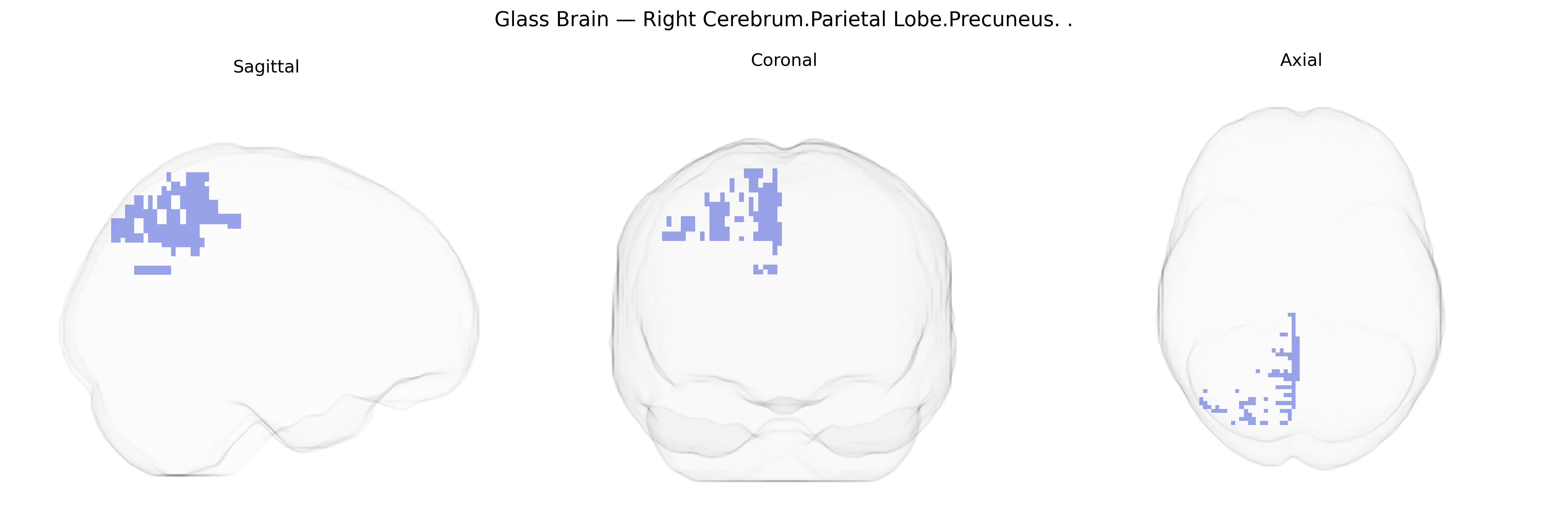 Triplanar Ghost Brain