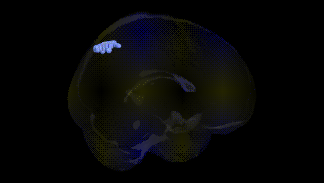 Full Brain Black