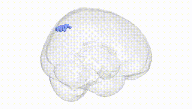 Full Brain White