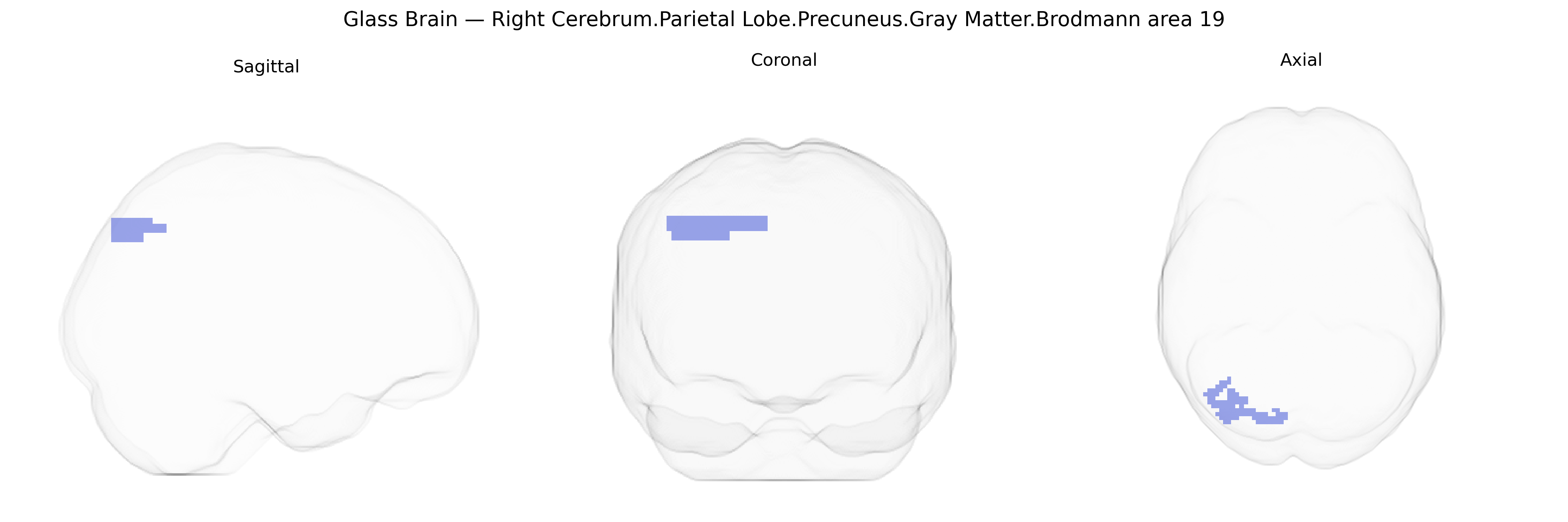 Triplanar Ghost Brain