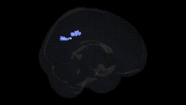 Full Brain Black