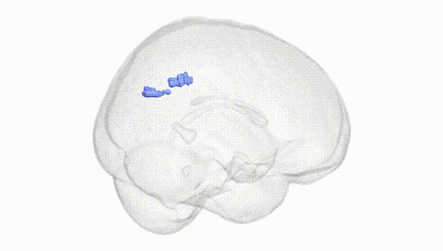 Full Brain White
