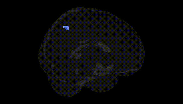 Full Brain Black
