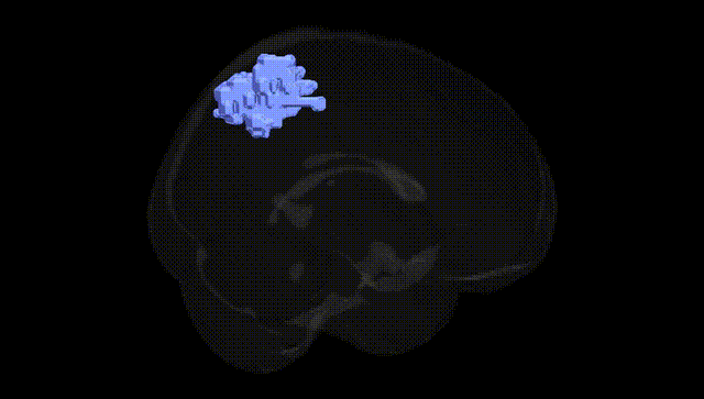 Full Brain Black