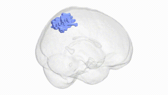 Full Brain White