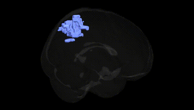 Full Brain Black