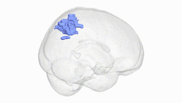 Full Brain White