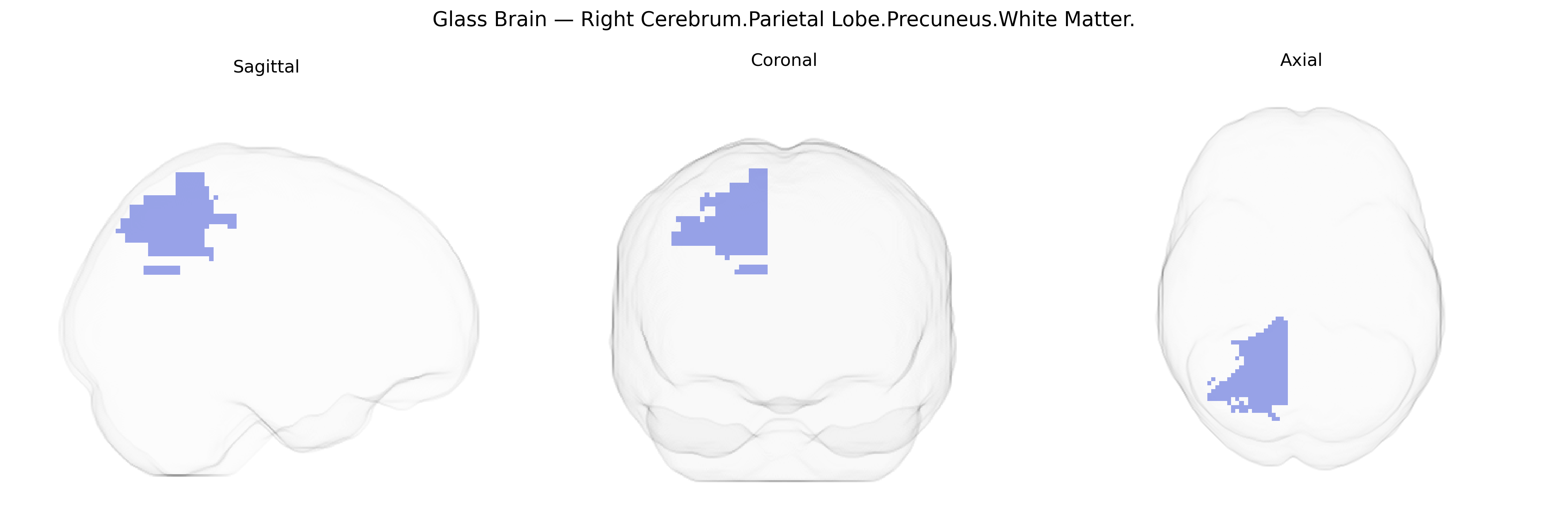 Triplanar Ghost Brain