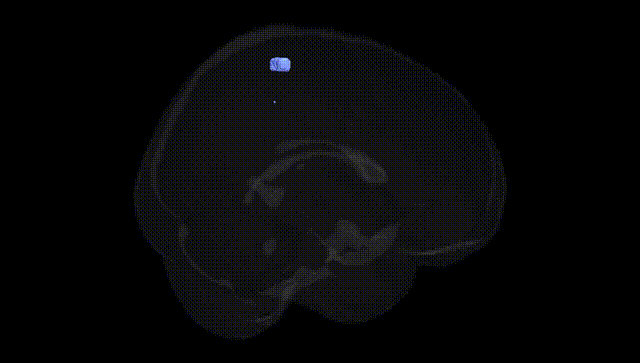 Full Brain Black