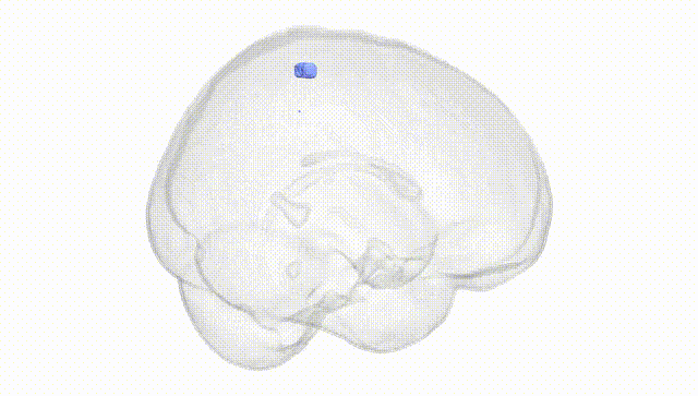 Full Brain White