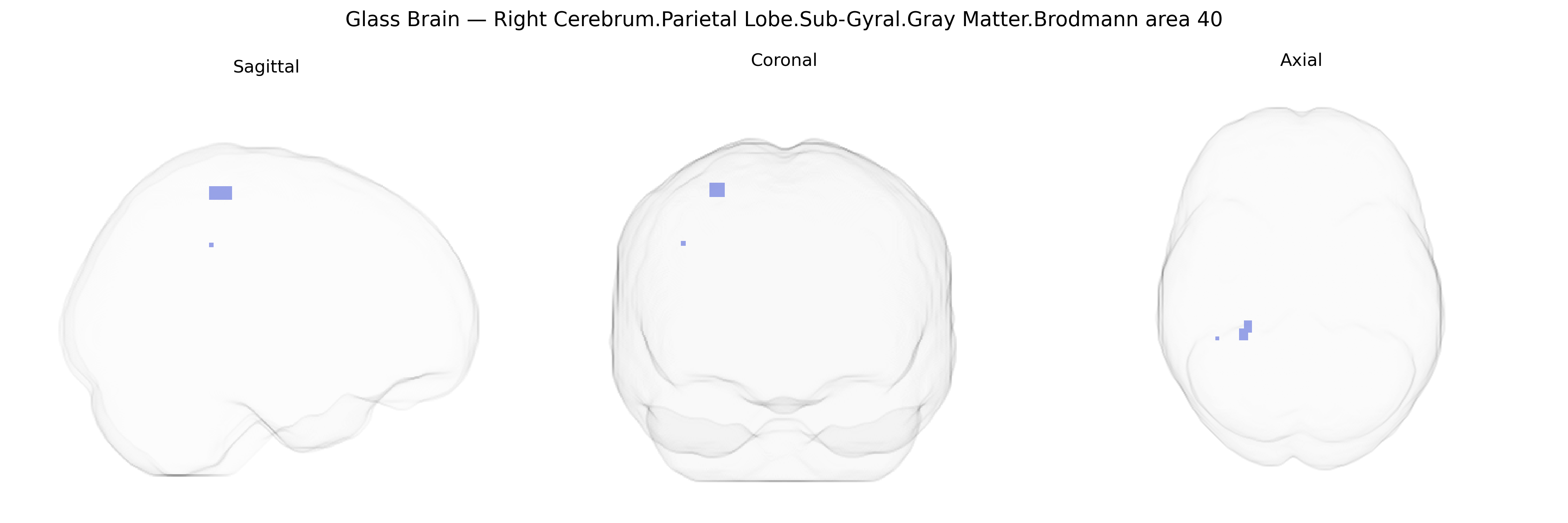 Triplanar Ghost Brain