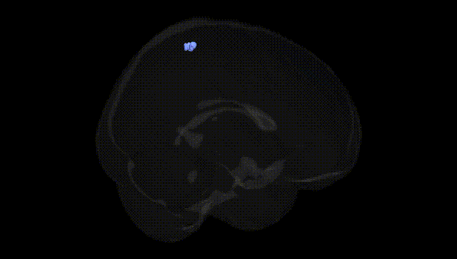 Full Brain Black