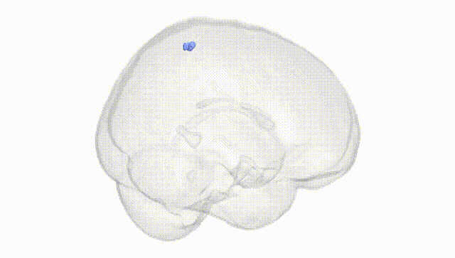 Full Brain White