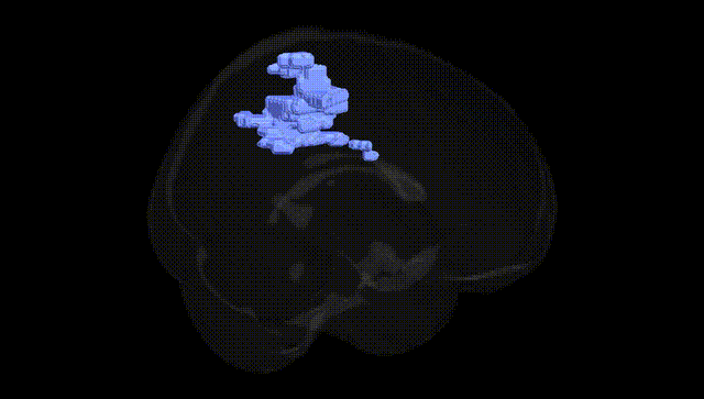 Full Brain Black