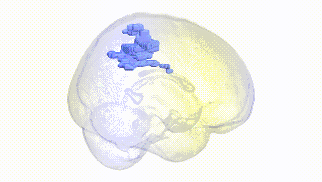 Full Brain White